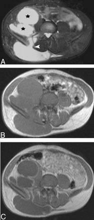 Fig 2.