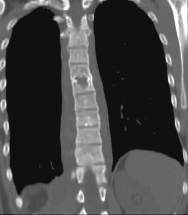 Fig 3.