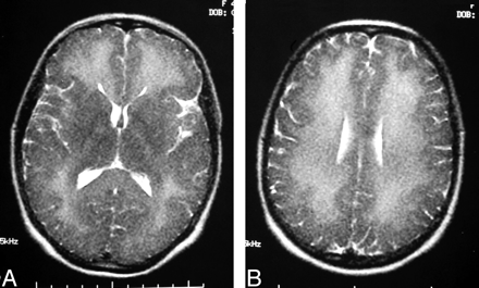Fig 1.