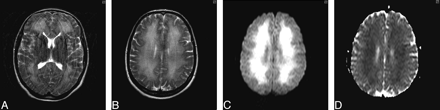 Fig 2.