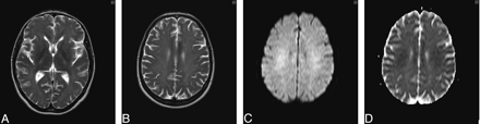 Fig 3.