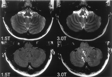 Fig 2.