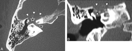 Fig 1.