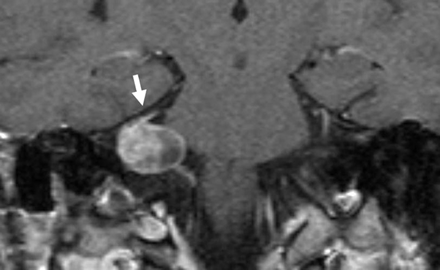 Fig 2.