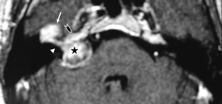 Fig 3.