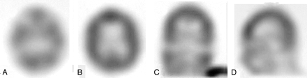   Fig 1. 