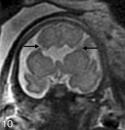 Fig 10.