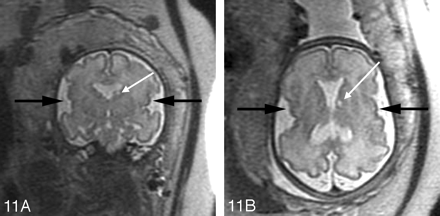 Fig 11.
