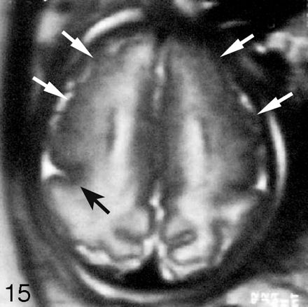 Fig 15.