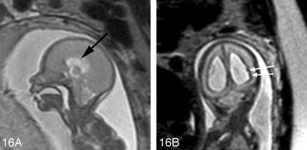 Fig 16.