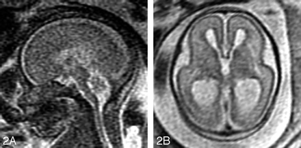 Fig 2.