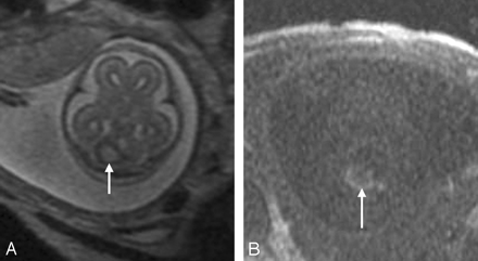 Fig 8.