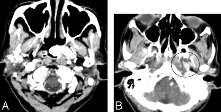 Fig 1.