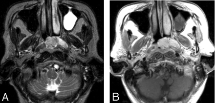 Fig 2.