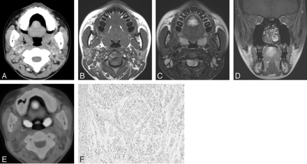   Fig 1. 