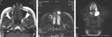 Fig 1.