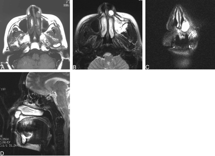 Fig 2.