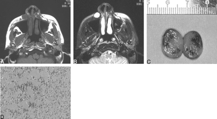 Fig 3.