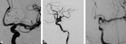 Fig 3.