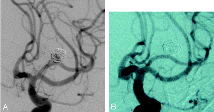 Fig 4.