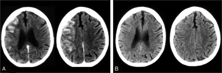 Fig 6.