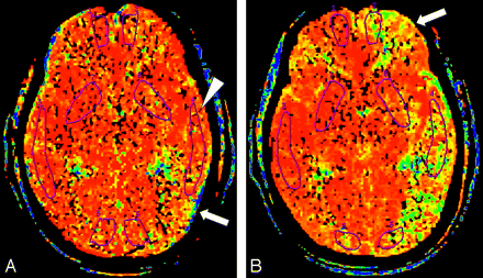 Fig 1.