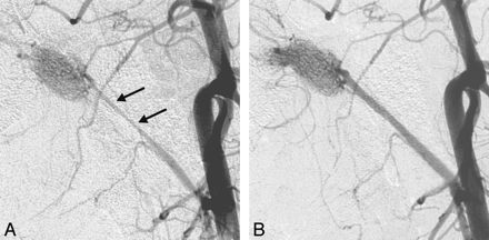 Fig 2.