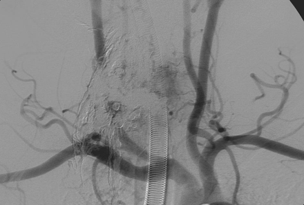 Fig 5.