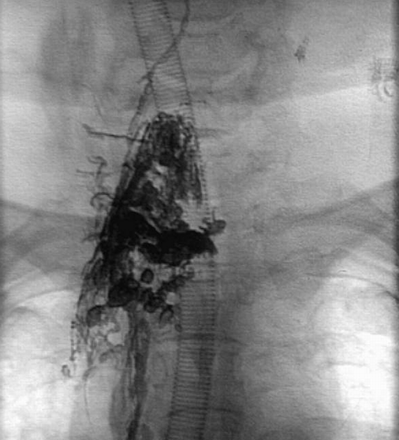 Fig 6.