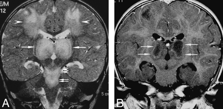 Fig 1.