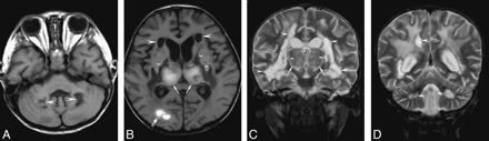 Fig 2.
