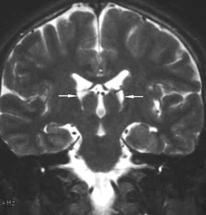 Fig 3.