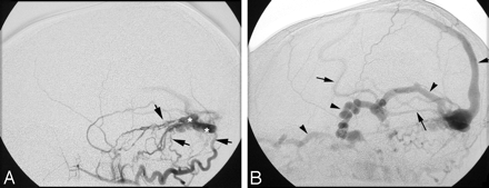 Fig 2.