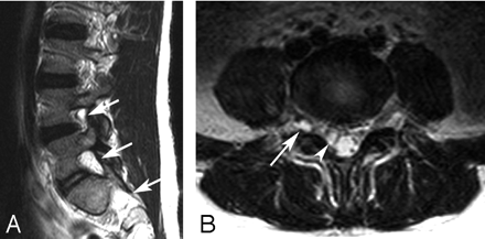 Fig 2.