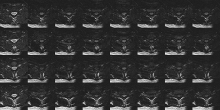 Fig 3.
