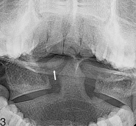 Fig 3.