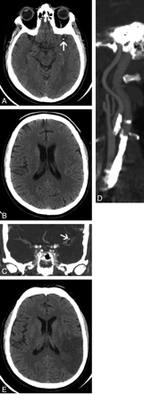 Fig 1.