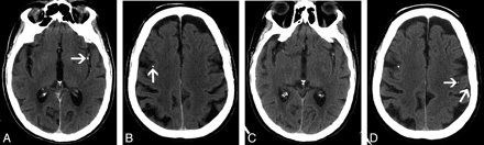 Fig 2.