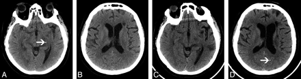 Fig 3.