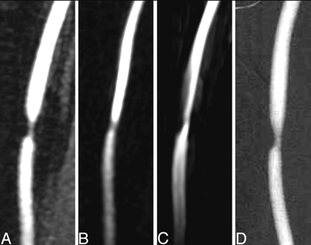 Fig 1.