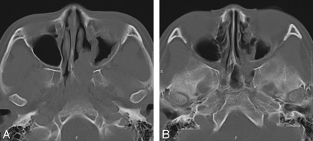 Fig 1.