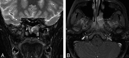 Fig 2.