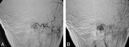 Fig 3.