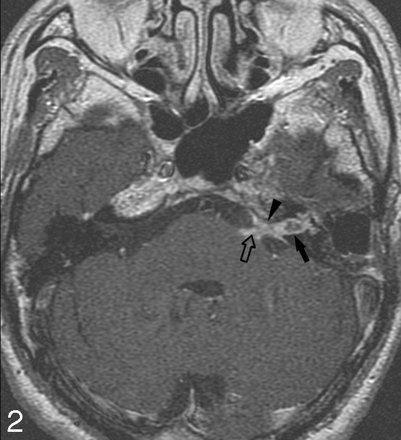 Fig 2.
