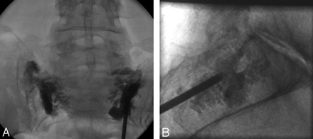 Fig 2.