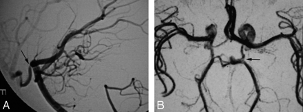 Fig 3.