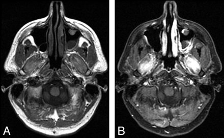 Fig 2.
