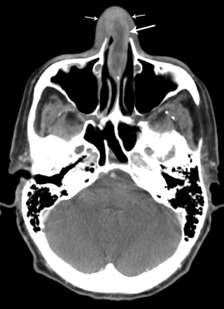 Fig 1.