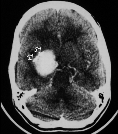 Fig 1.