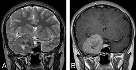 Fig 2.